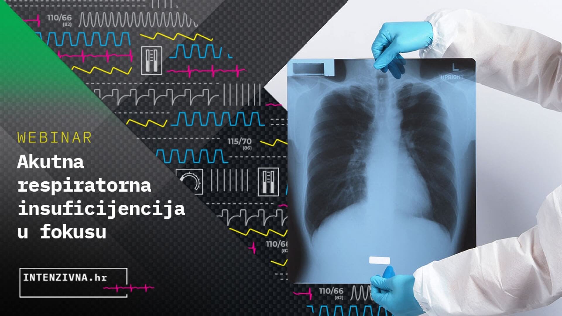 Akutna respiratorna insuficijencija u fokusu