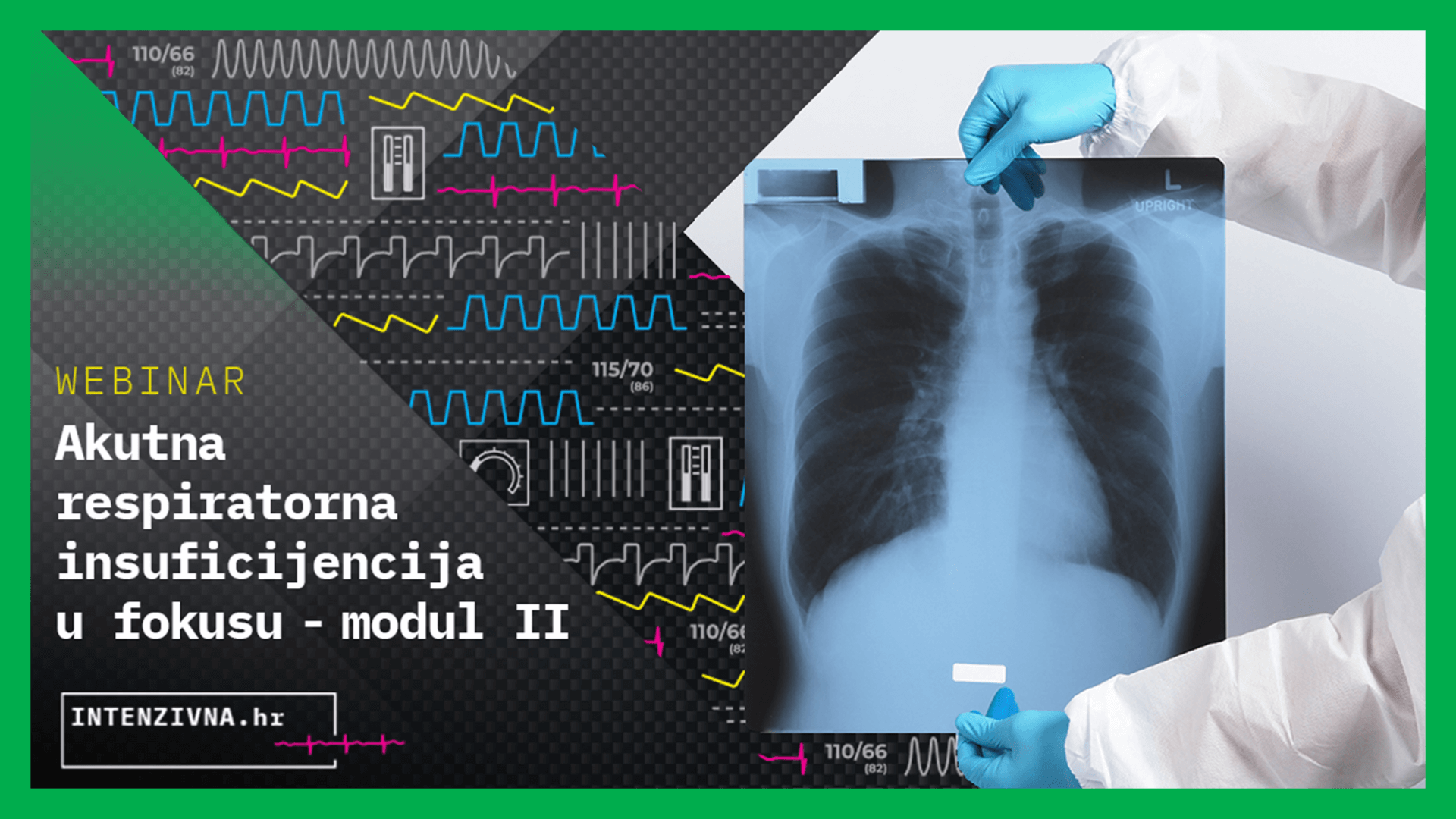 Akutna respiratorna insuficijencija u fokusu - modul II
