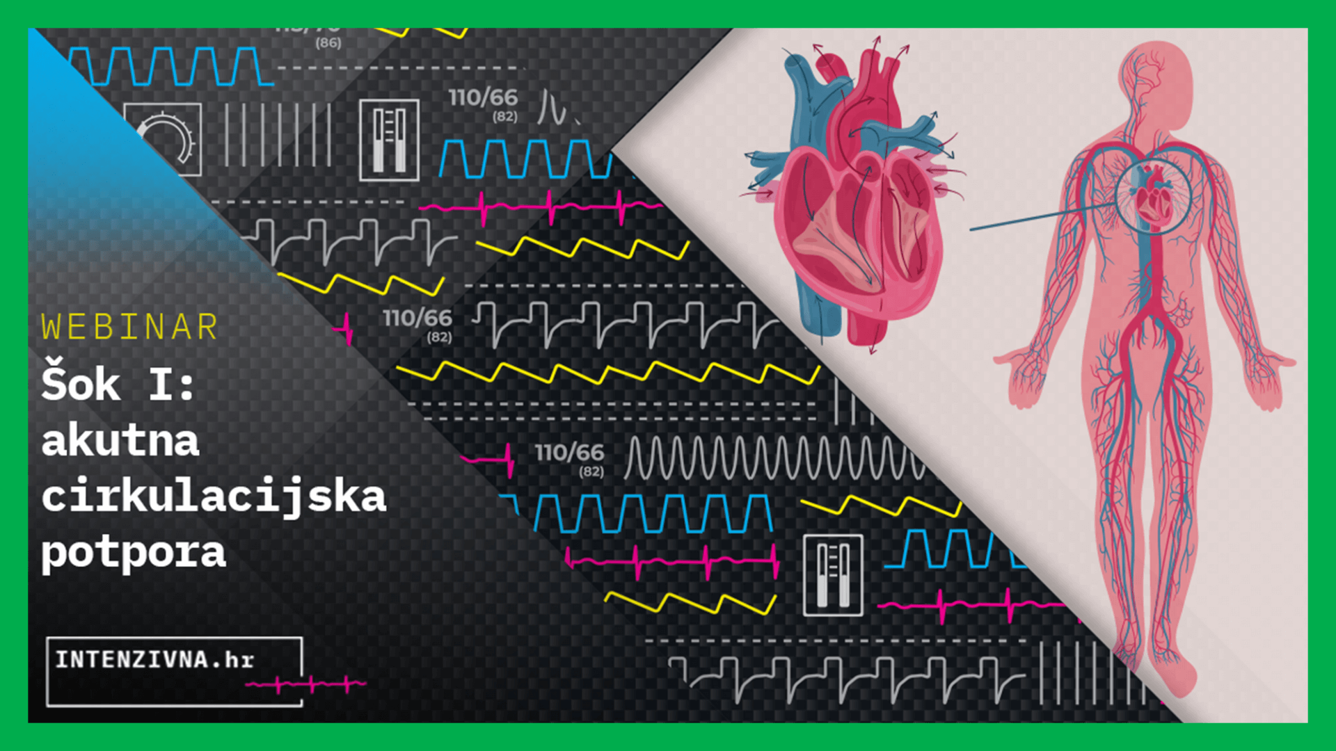 Šok I: akutna cirkulacijska potpora