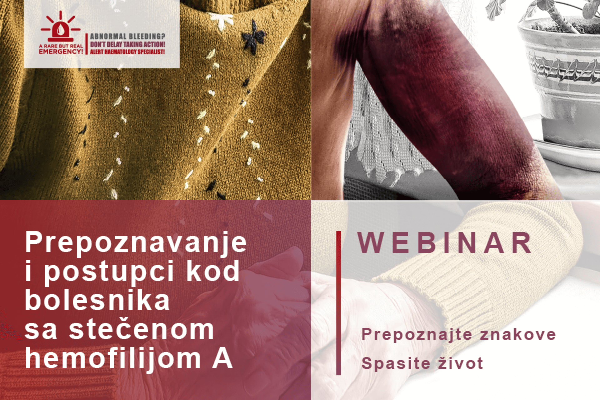 Prepoznavanje i postupci kod bolesnika sa stečenom hemofilijom A