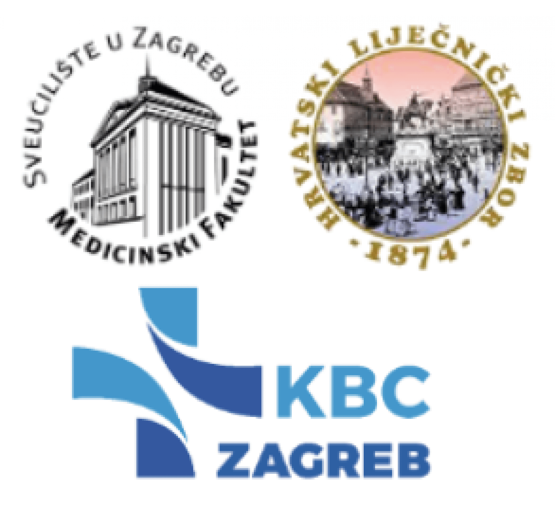 Akutni ishemijski moždani udar - što u prvih 48 sati?