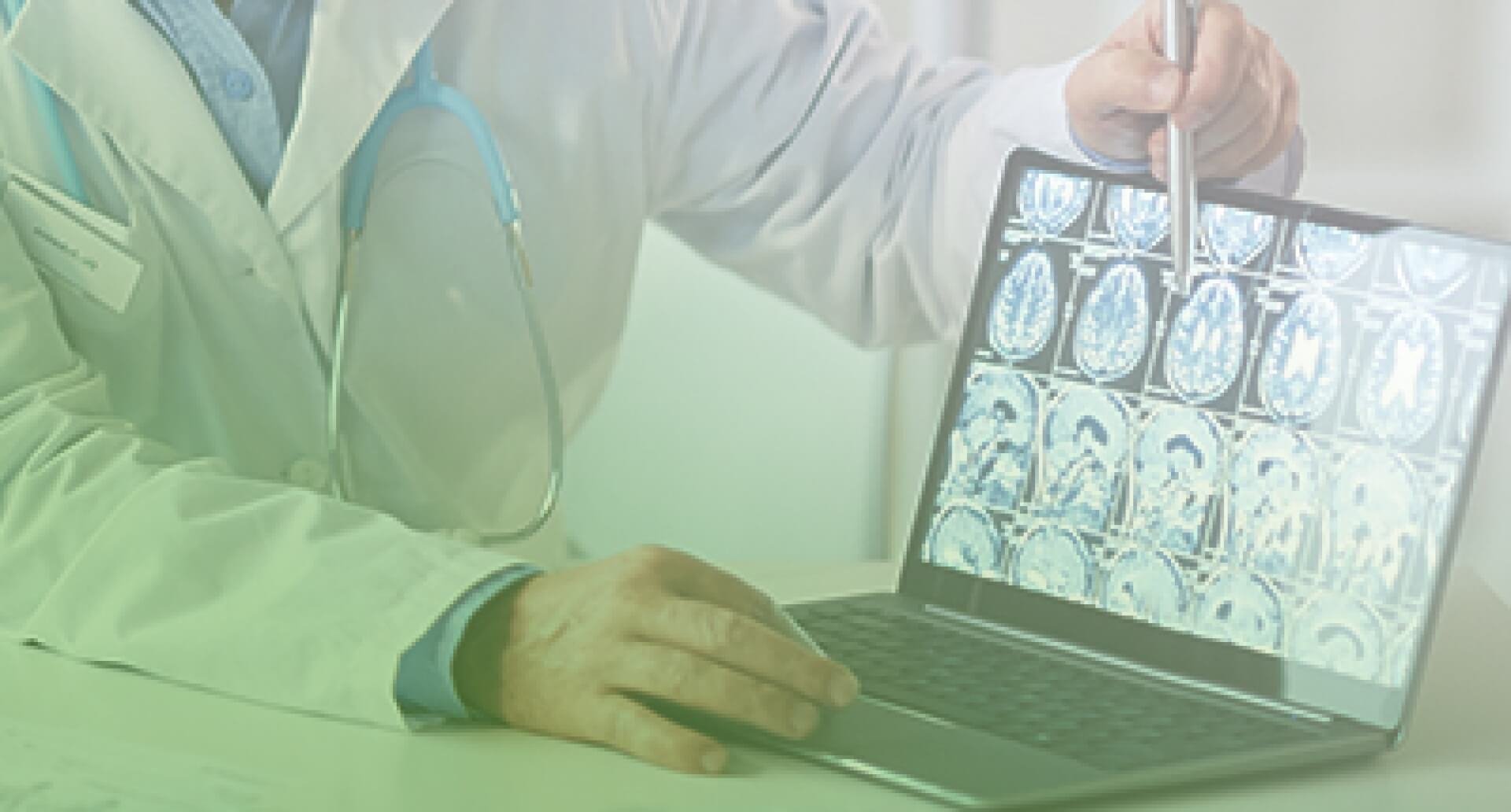 Liječenje i sekundarna prevencija moždanog udara