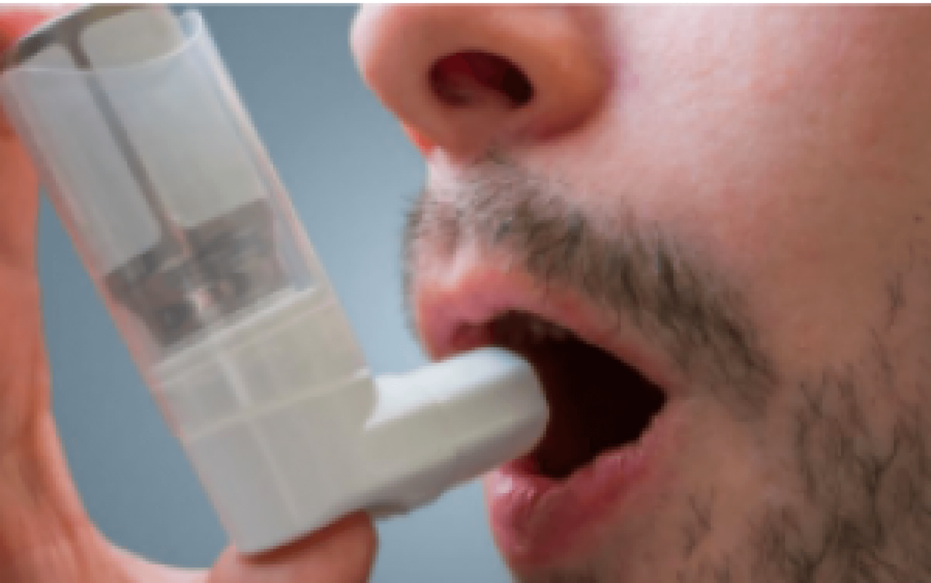 Video predavanje: ASTMA - Što je novo u GINA smjernicama?