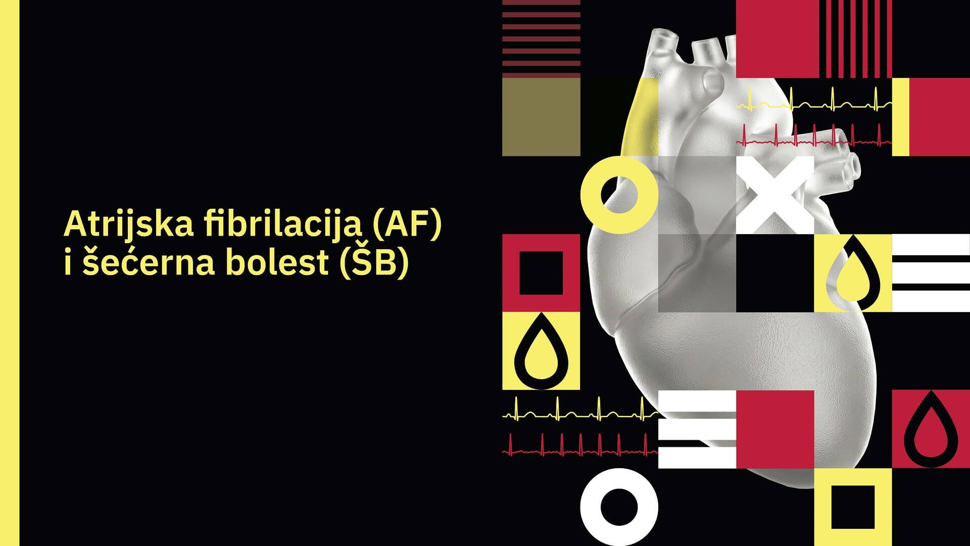 Atrijska fibrilacija (AF) i šećerna bolest (ŠB)
